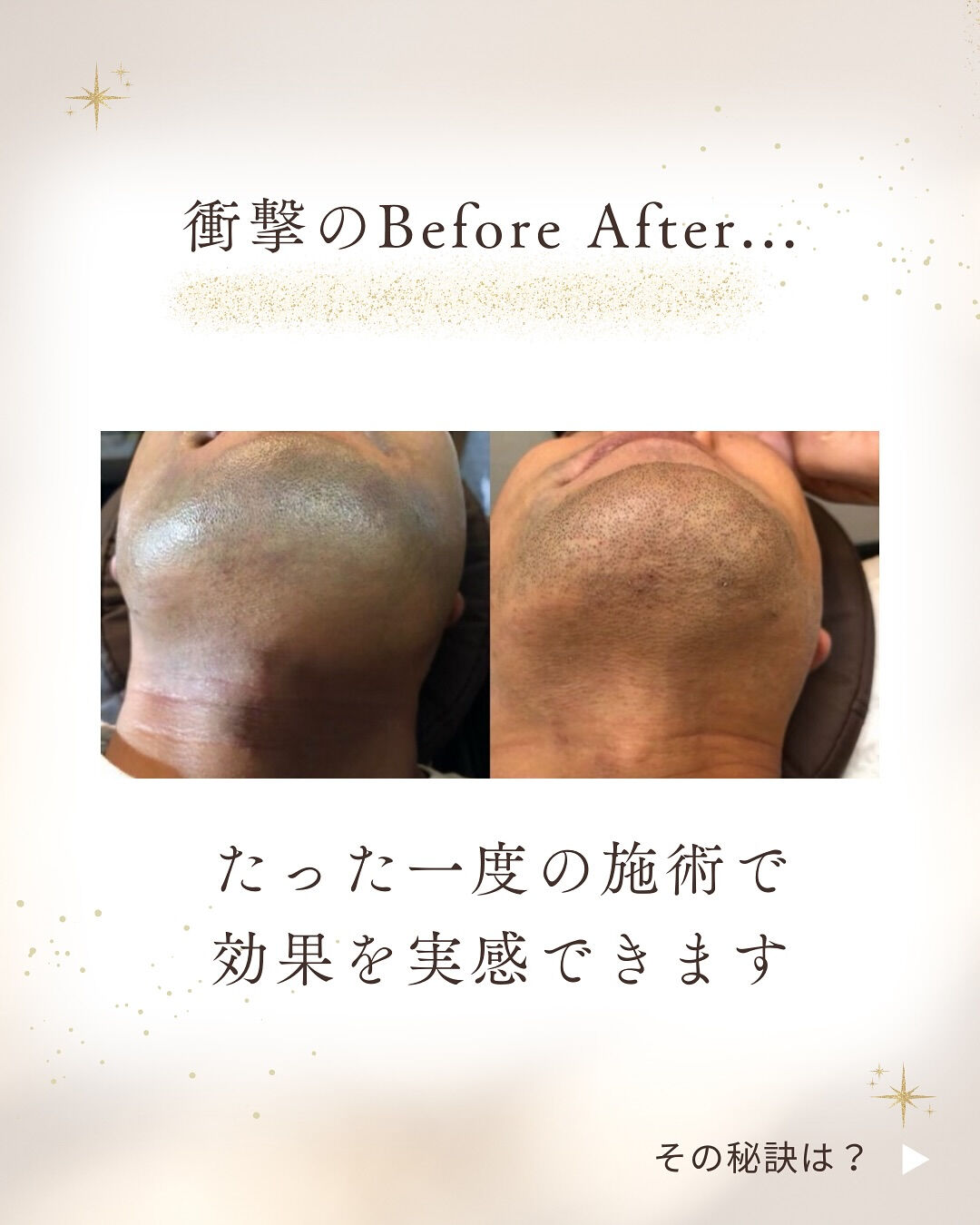 👇他の投稿はこちら