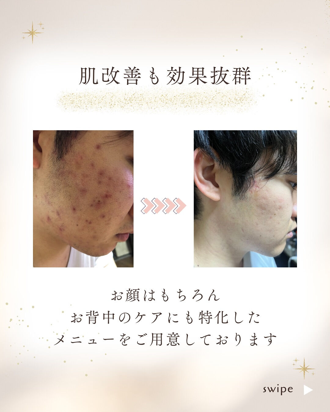 👇他の投稿はこちら