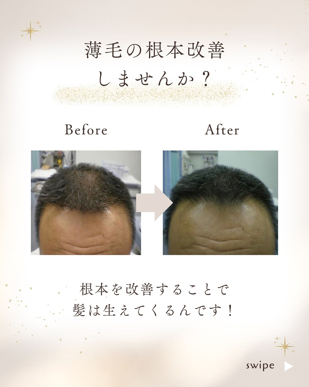 👇他の投稿はこちら