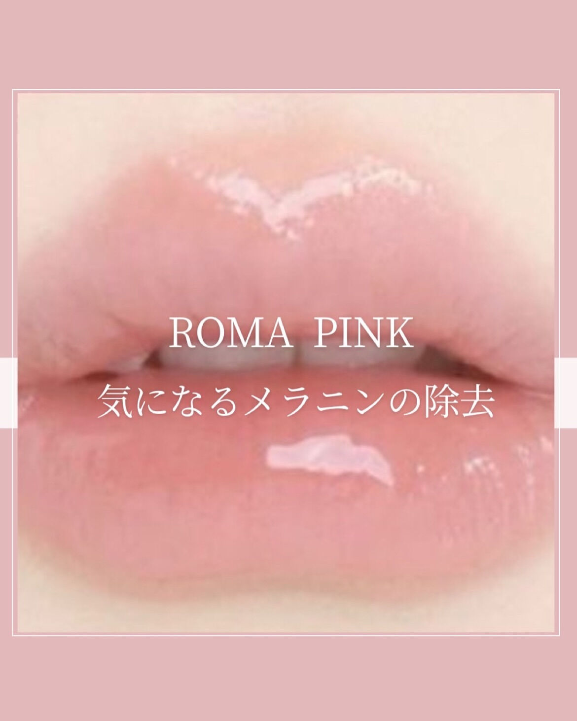 👇他の投稿はこちら