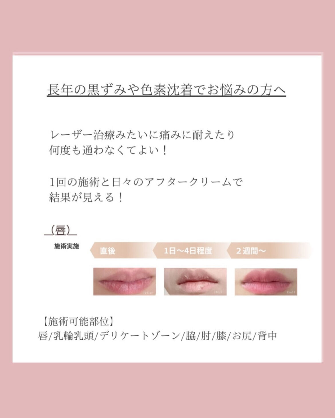 👇他の投稿はこちら