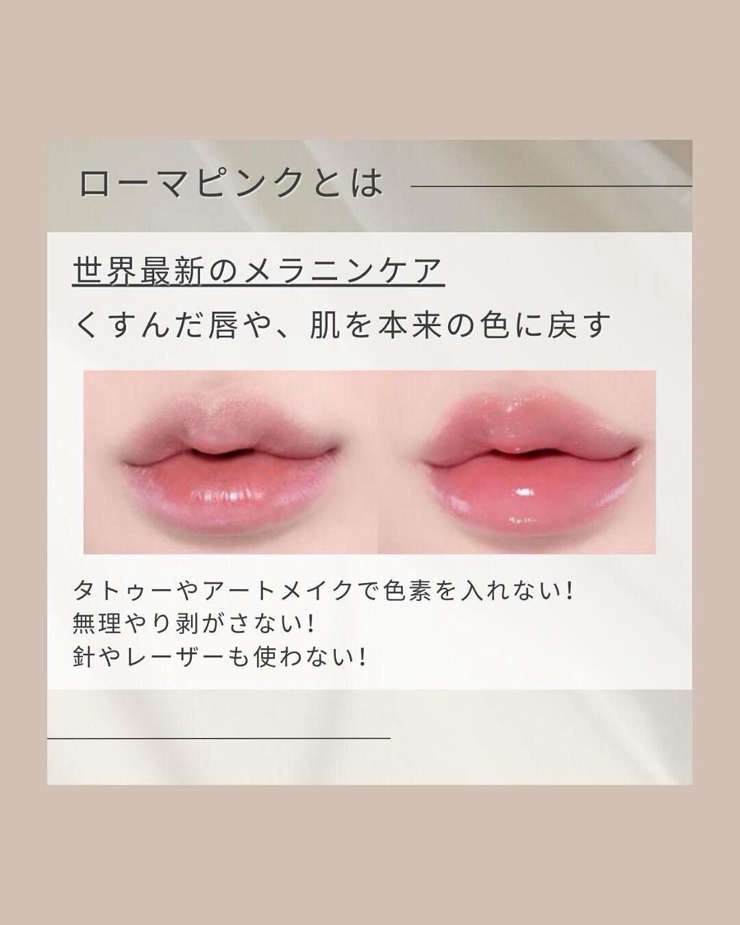 👇他の投稿はこちら