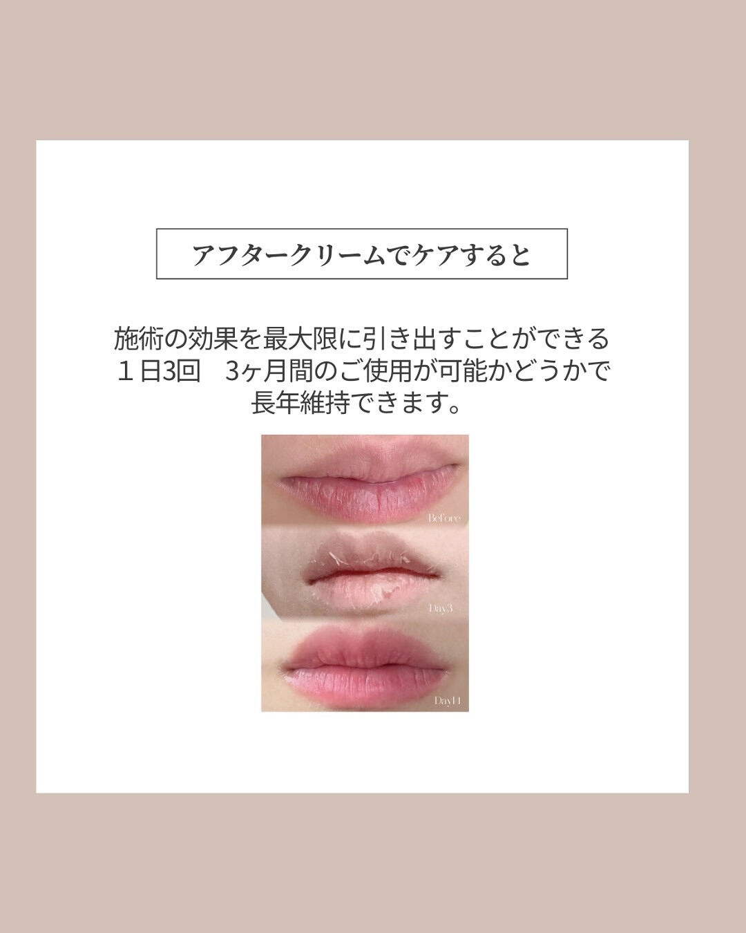 👇他の投稿はこちら