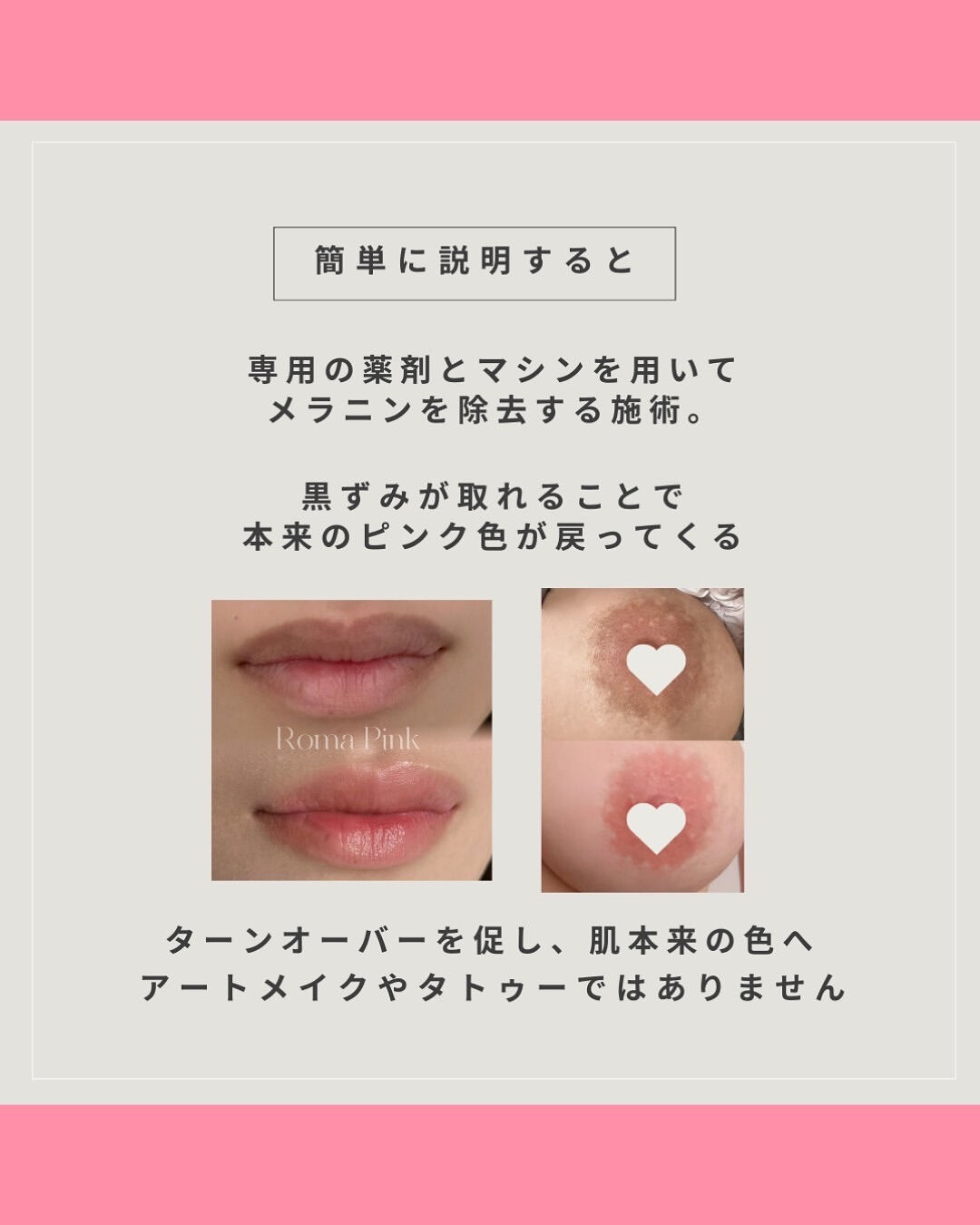 👇他の投稿はこちら