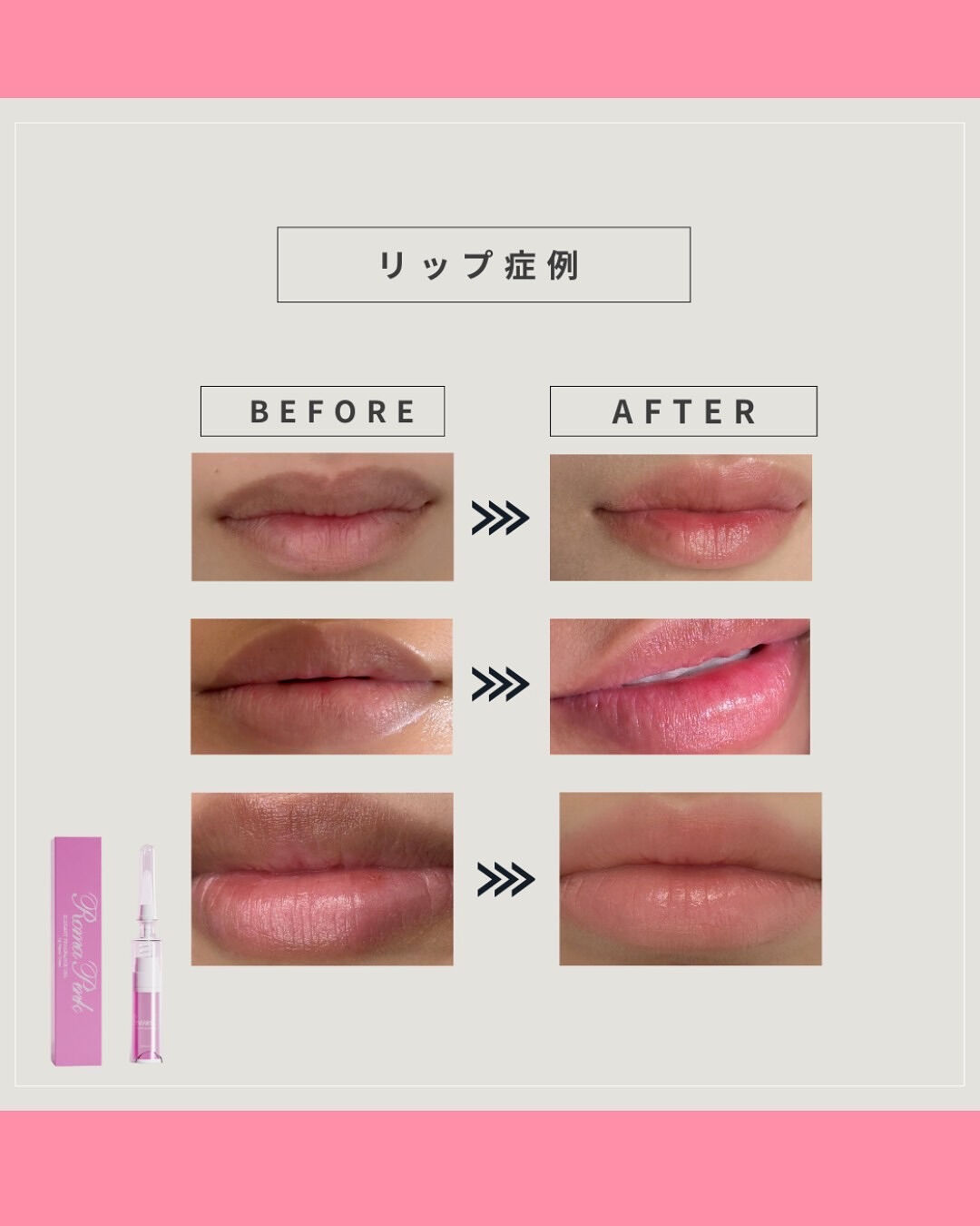 👇他の投稿はこちら