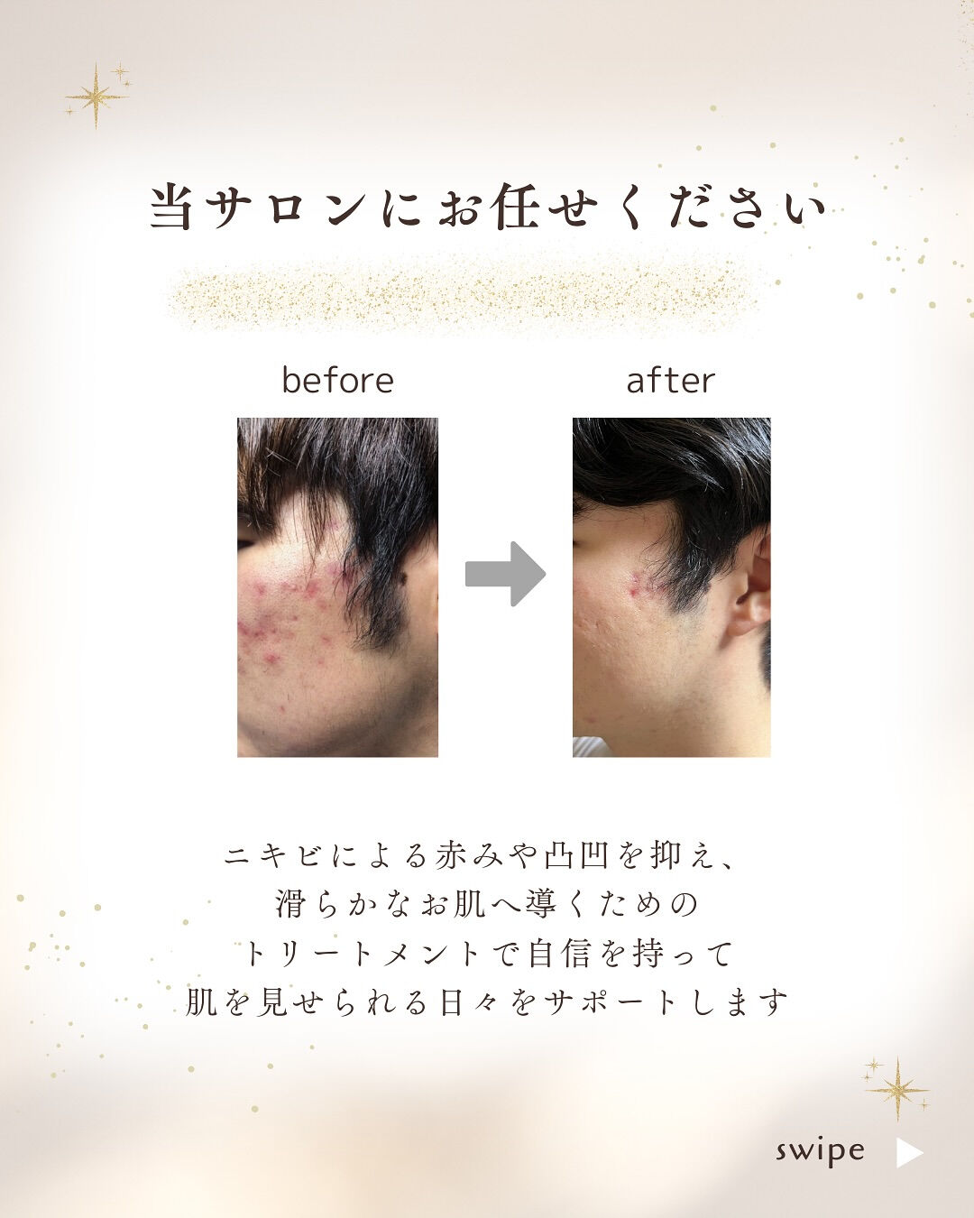 👇他の投稿はこちら