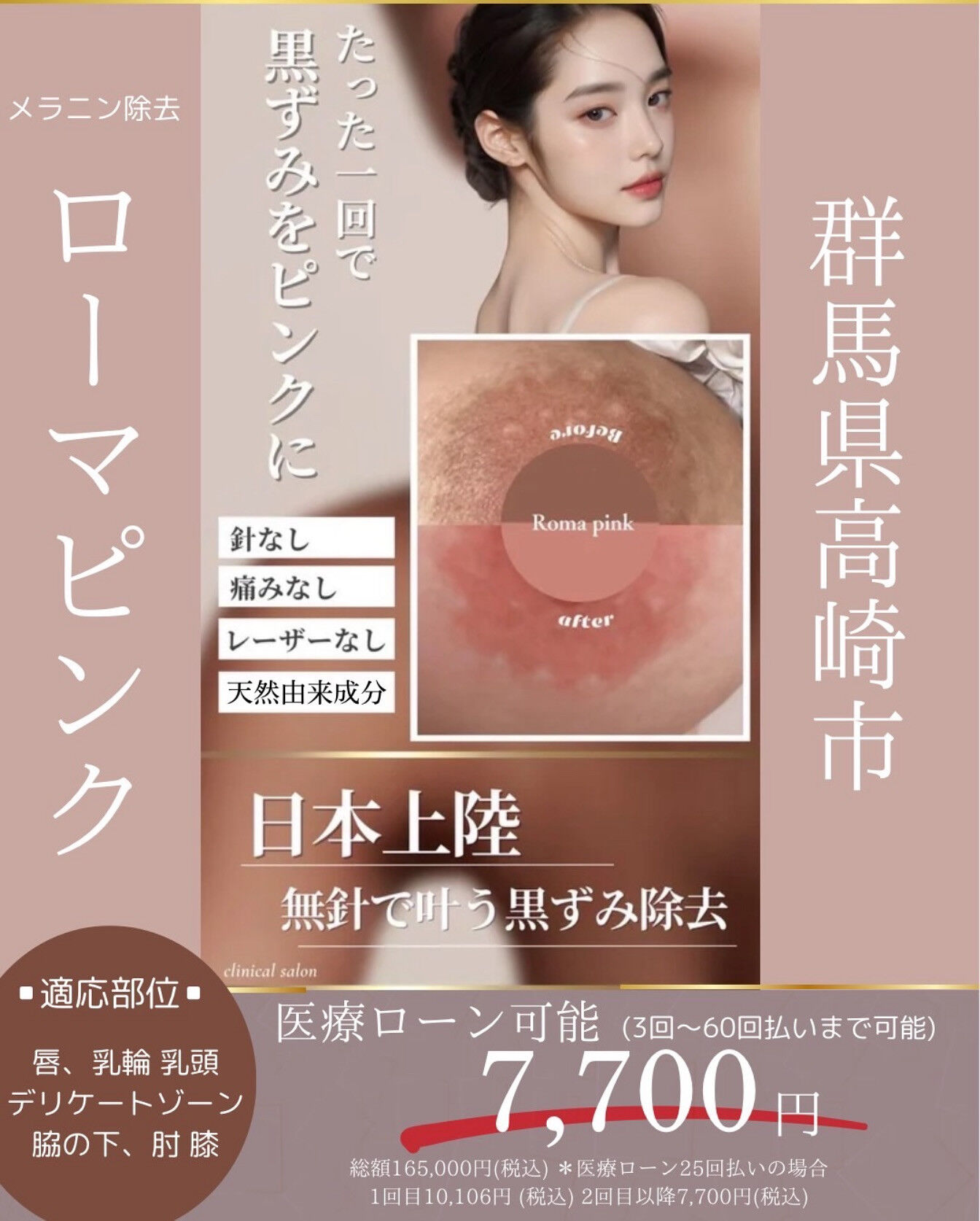 👇他の投稿はこちら