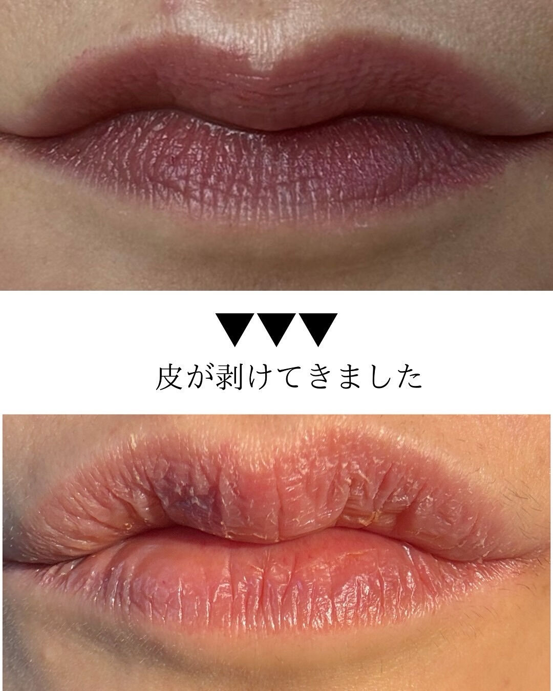 👇他の投稿はこちら