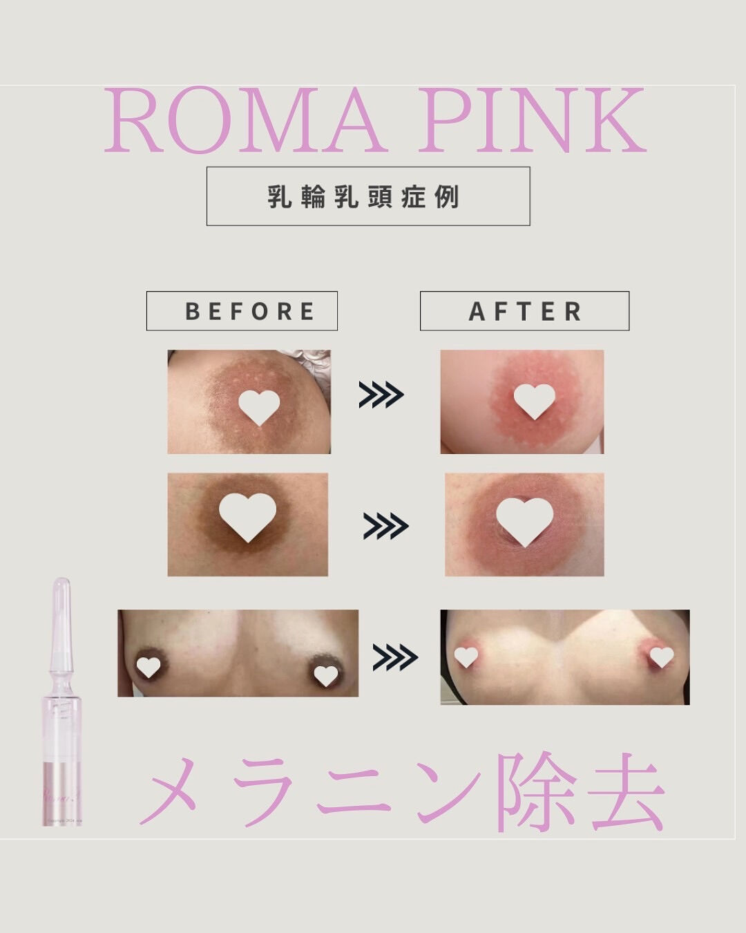 👇他の投稿はこちら