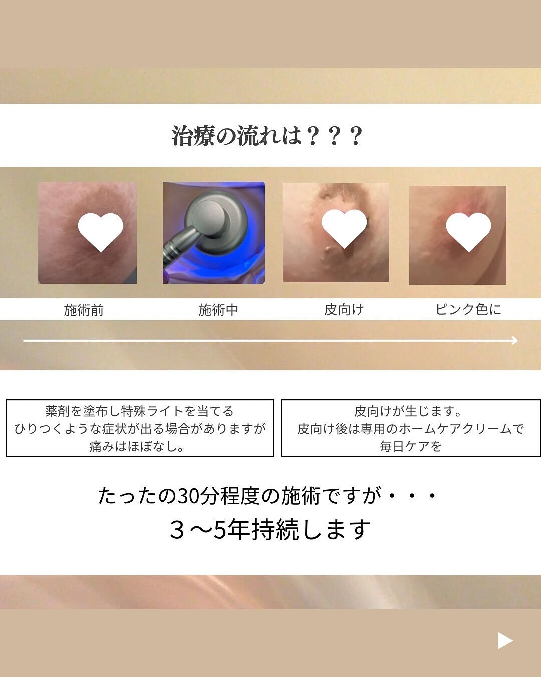 👇他の投稿はこちら