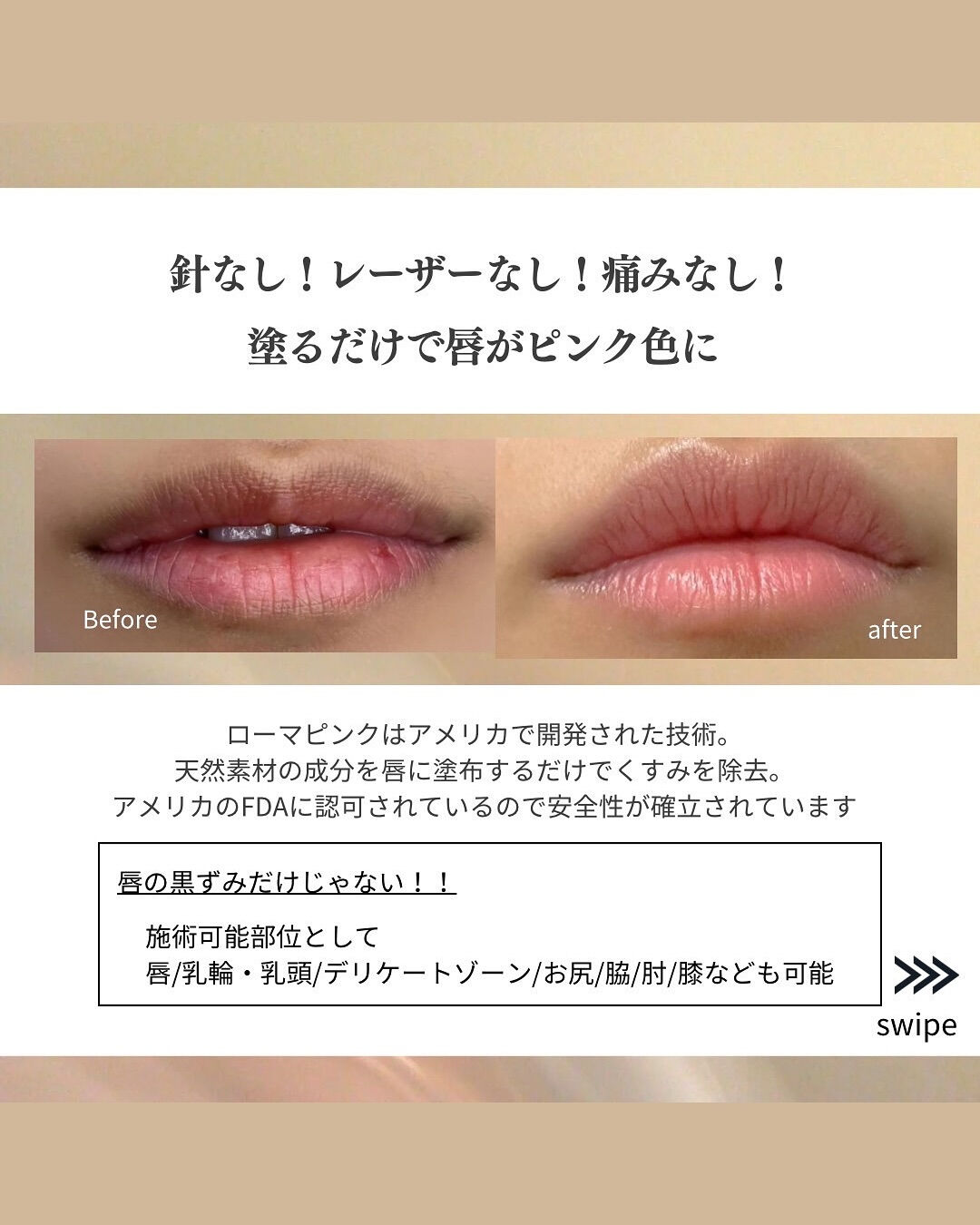 👇他の投稿はこちら