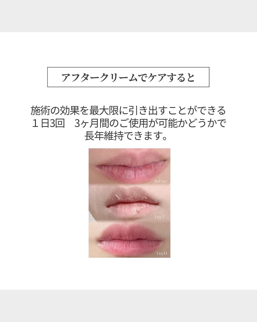 👇他の投稿はこちら