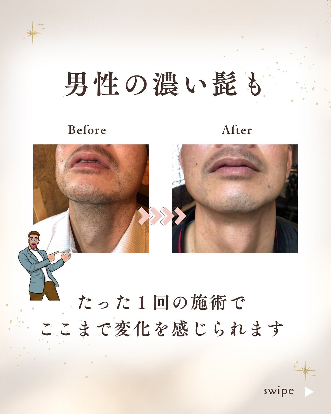 👇他の投稿はこちら