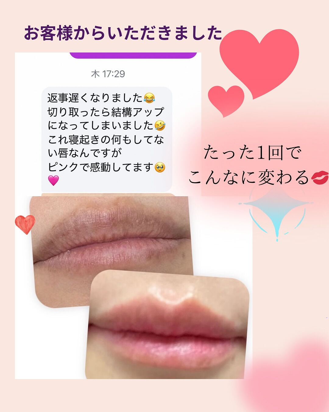 👇他の投稿はこちら