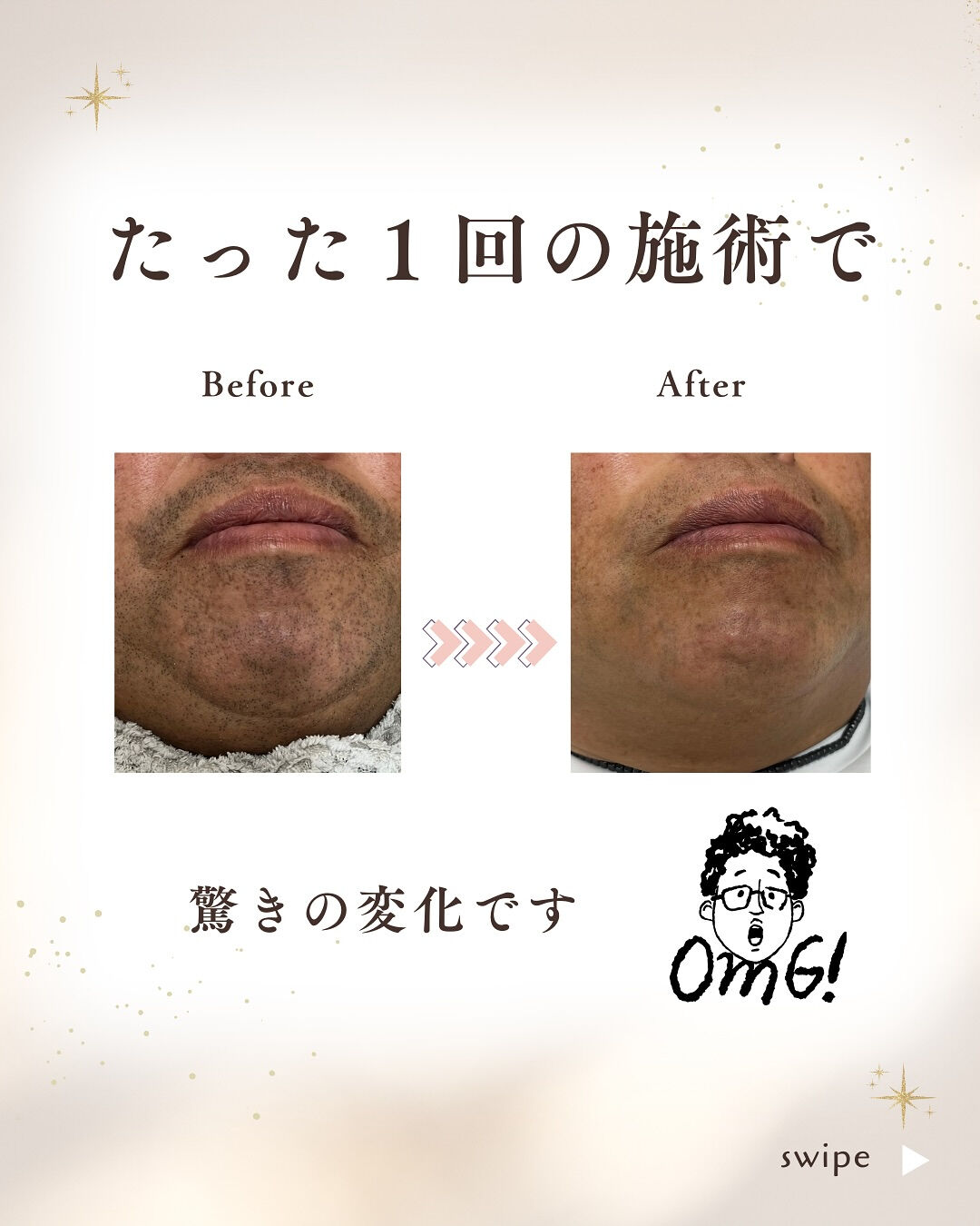 👇他の投稿はこちら