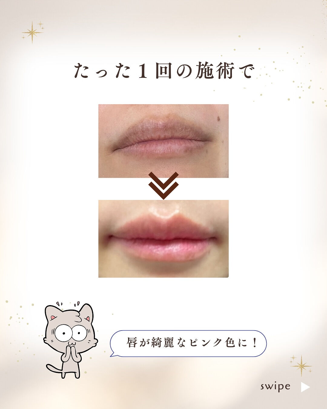 👇他の投稿はこちら