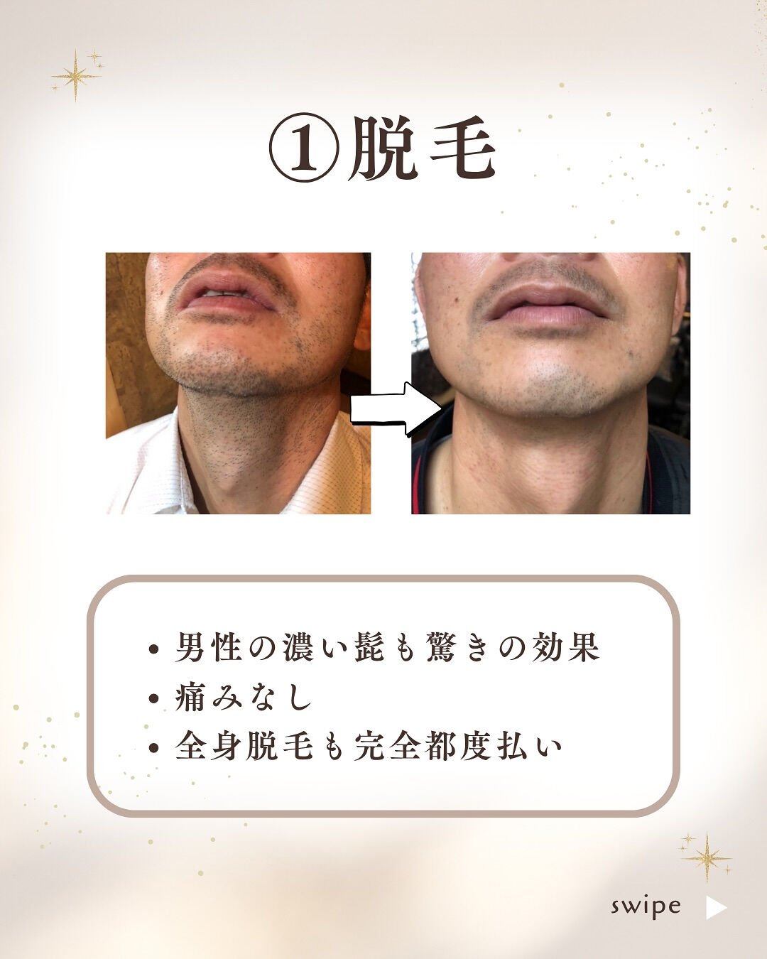 👇他の投稿はこちら
