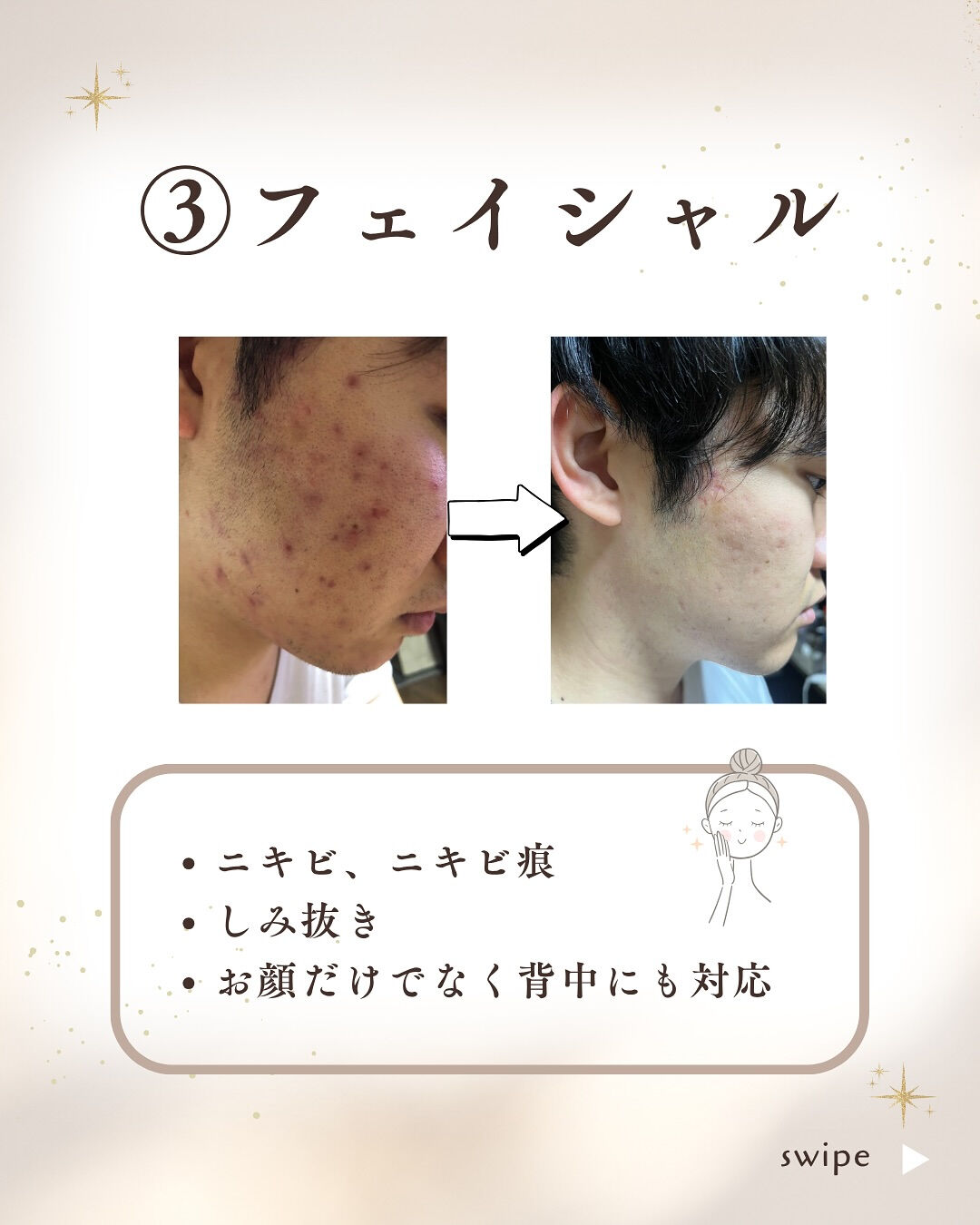 👇他の投稿はこちら