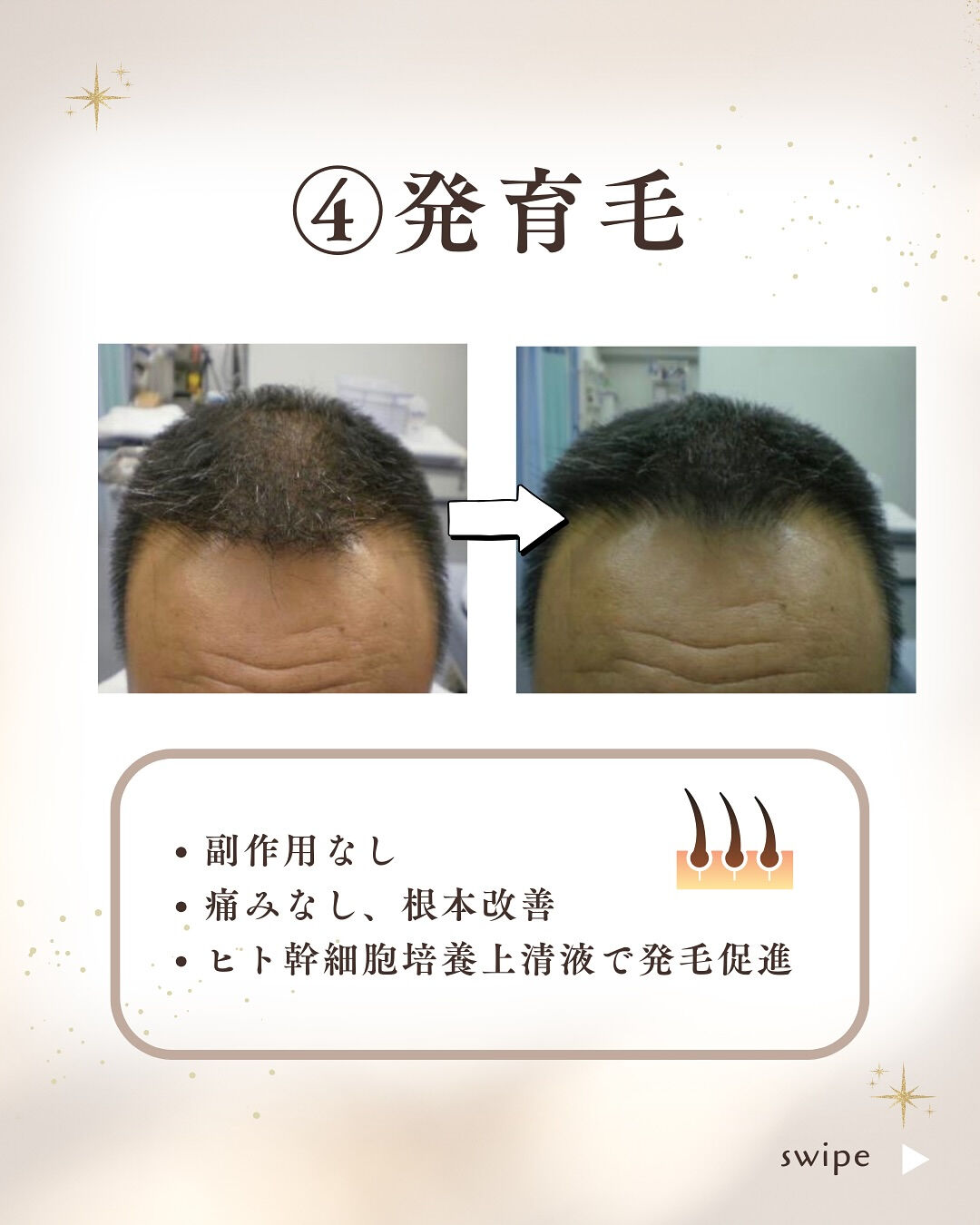 👇他の投稿はこちら