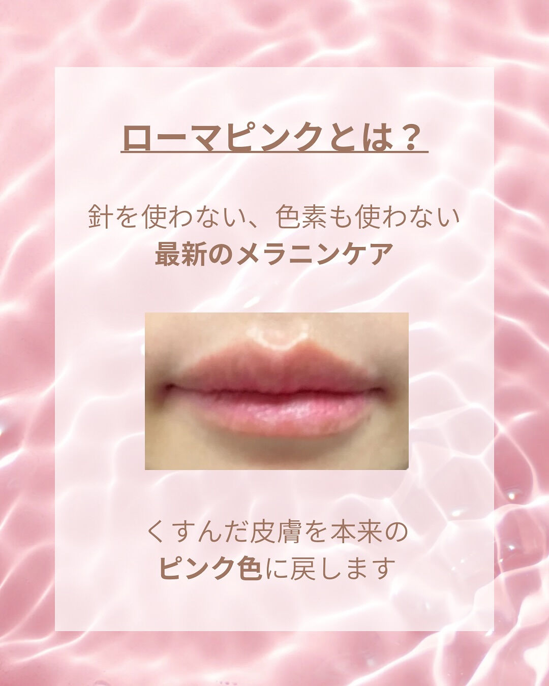 👇他の投稿はこちら