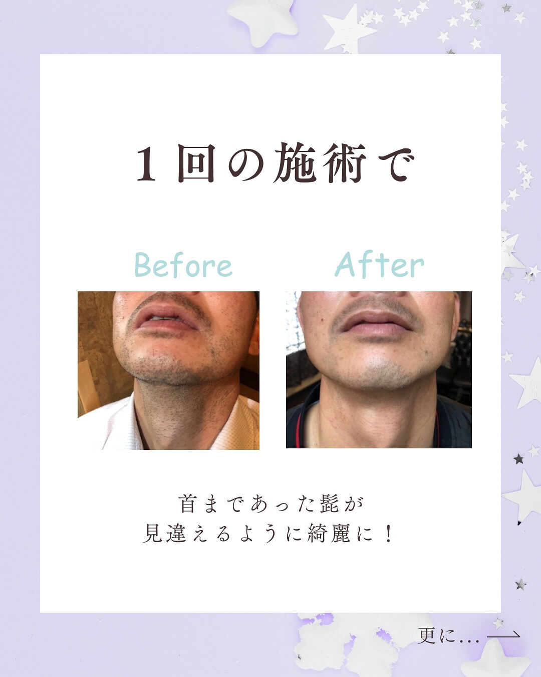 👇他の投稿はこちら