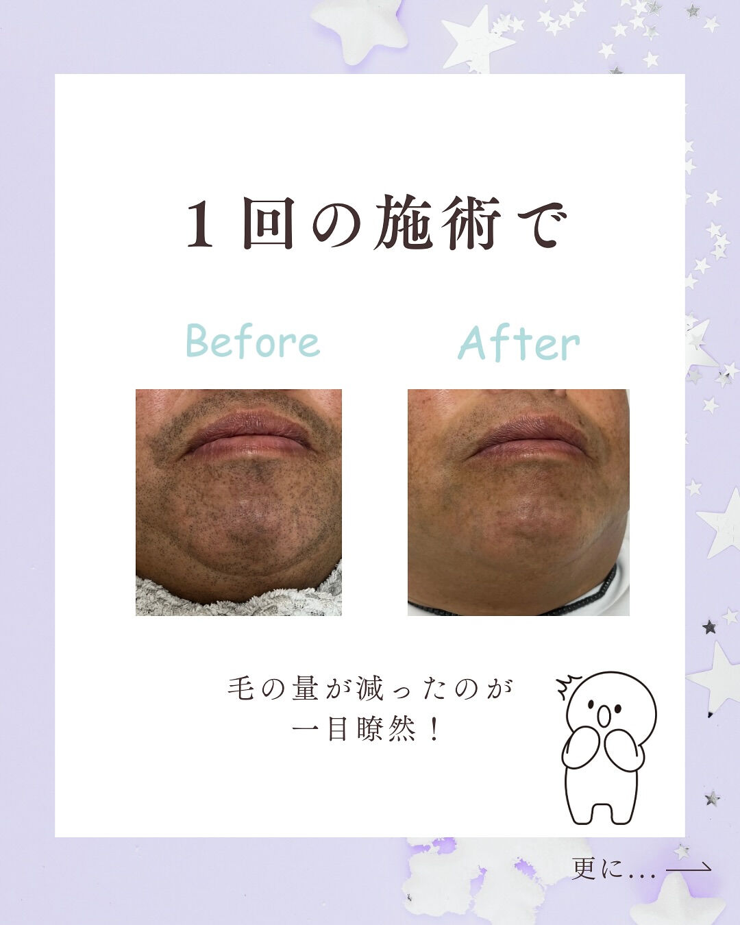 👇他の投稿はこちら