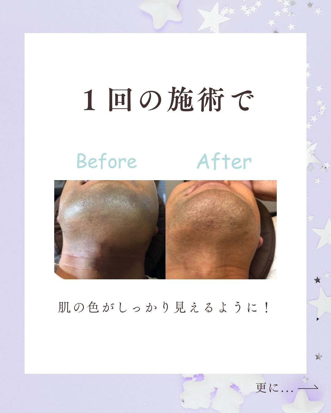 👇他の投稿はこちら