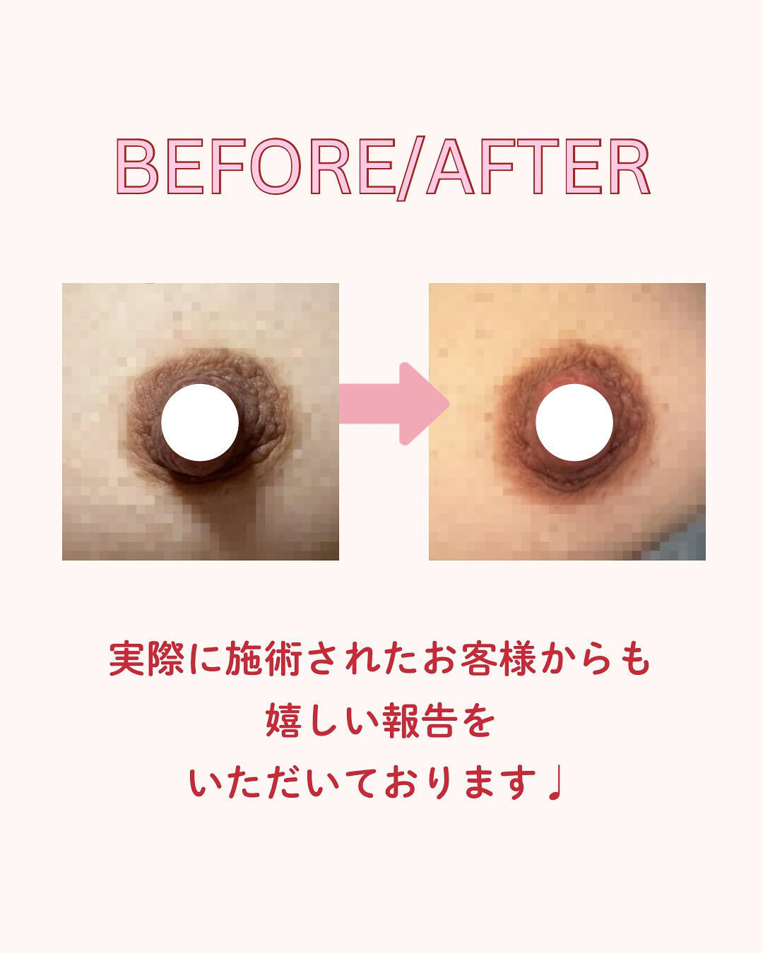👇他の投稿はこちら