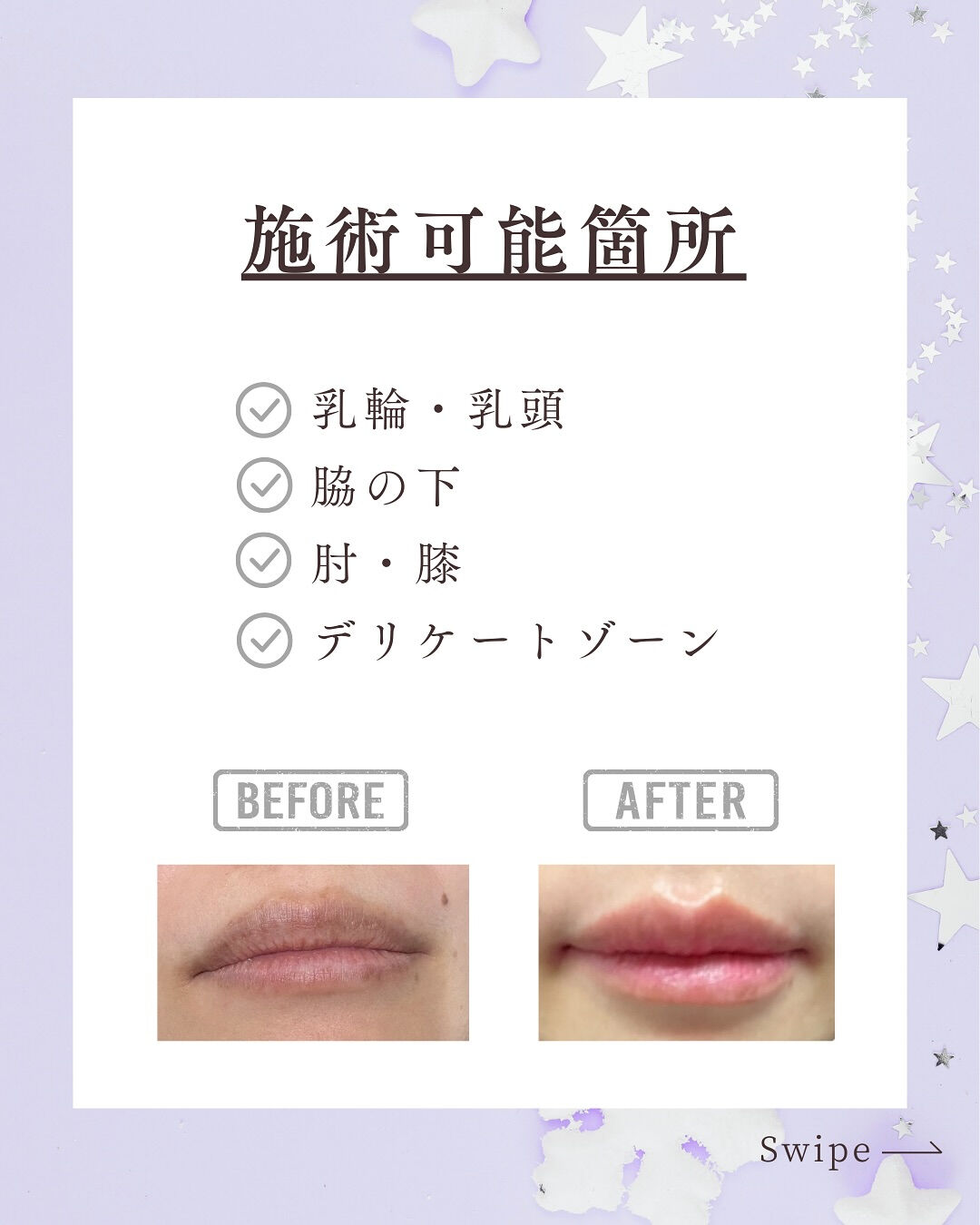 👇他の投稿はこちら