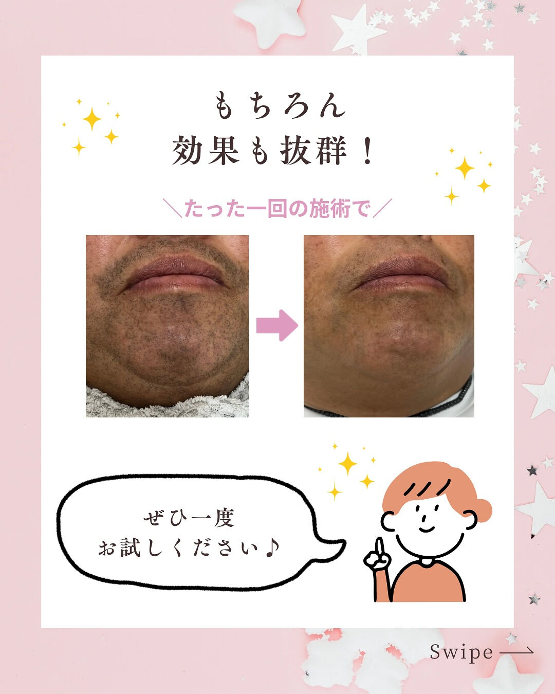 👇他の投稿はこちら