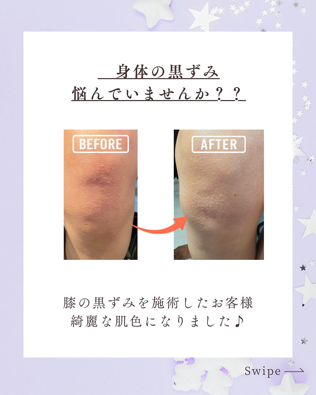 👇他の投稿はこちら
