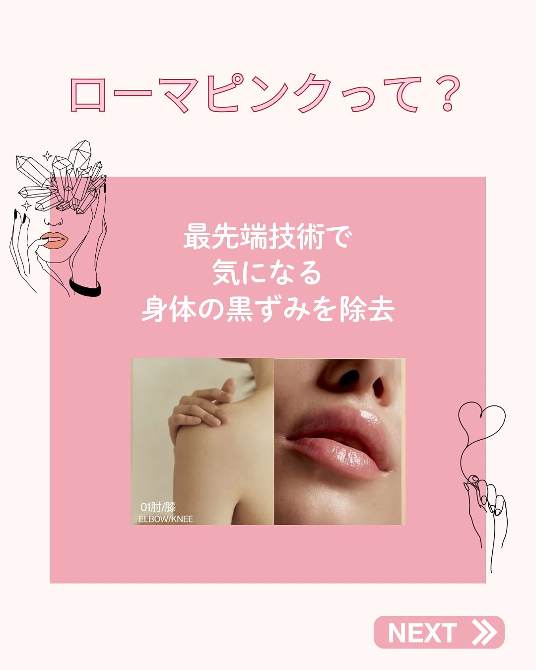 👇他の投稿はこちら