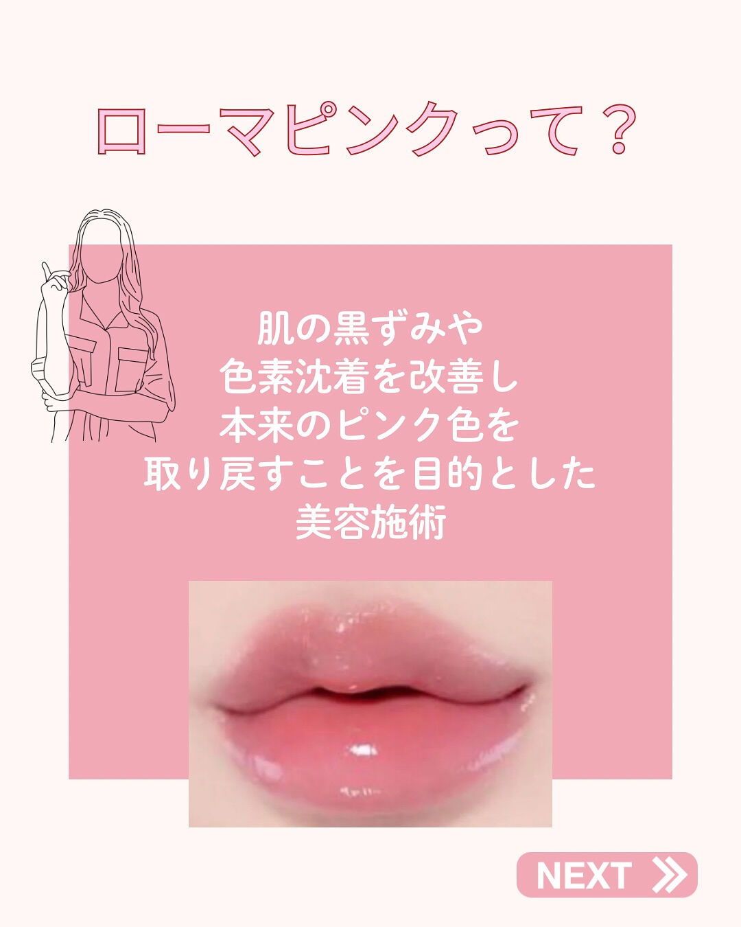 👇他の投稿はこちら