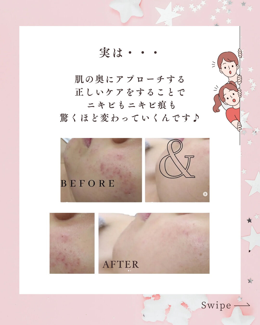 👇他の投稿はこちら
