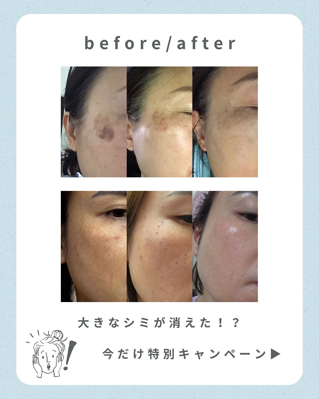 👇他の投稿はこちら