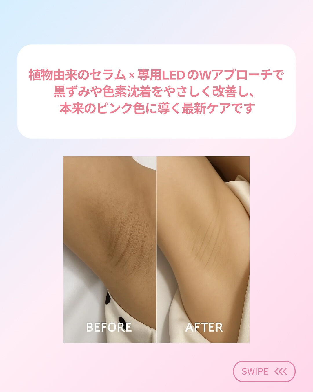 👇他の投稿はこちら