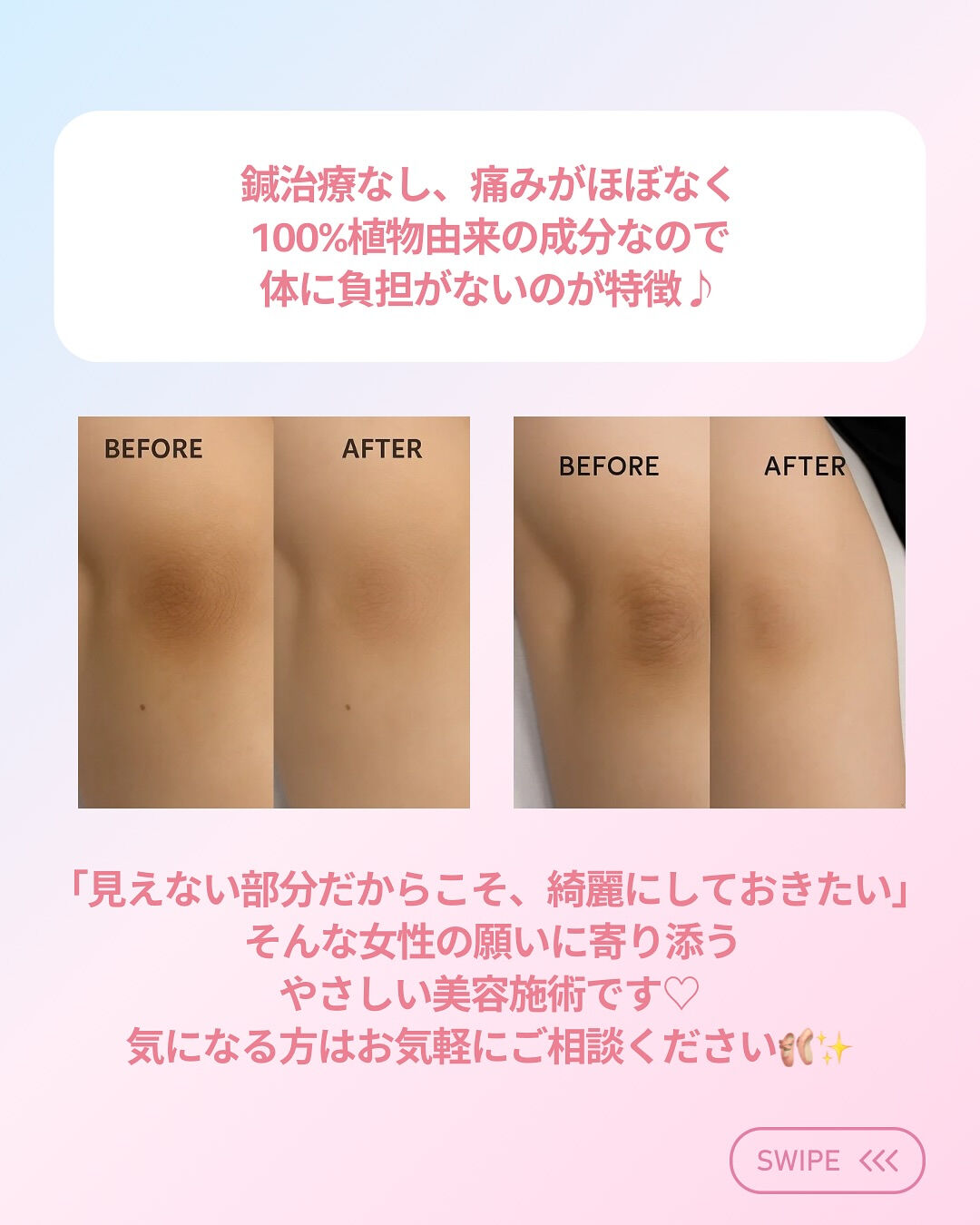 👇他の投稿はこちら