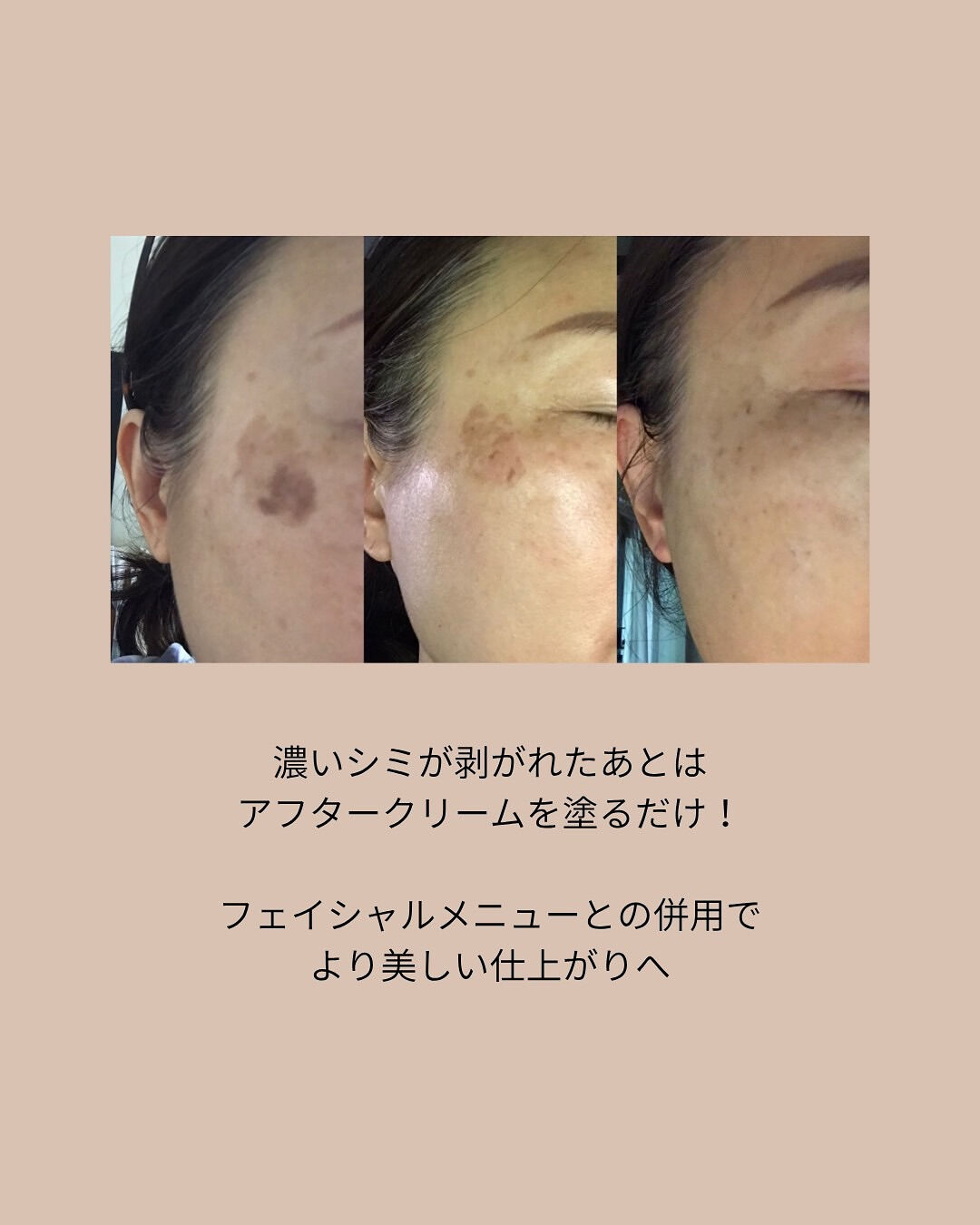 👇他の投稿はこちら