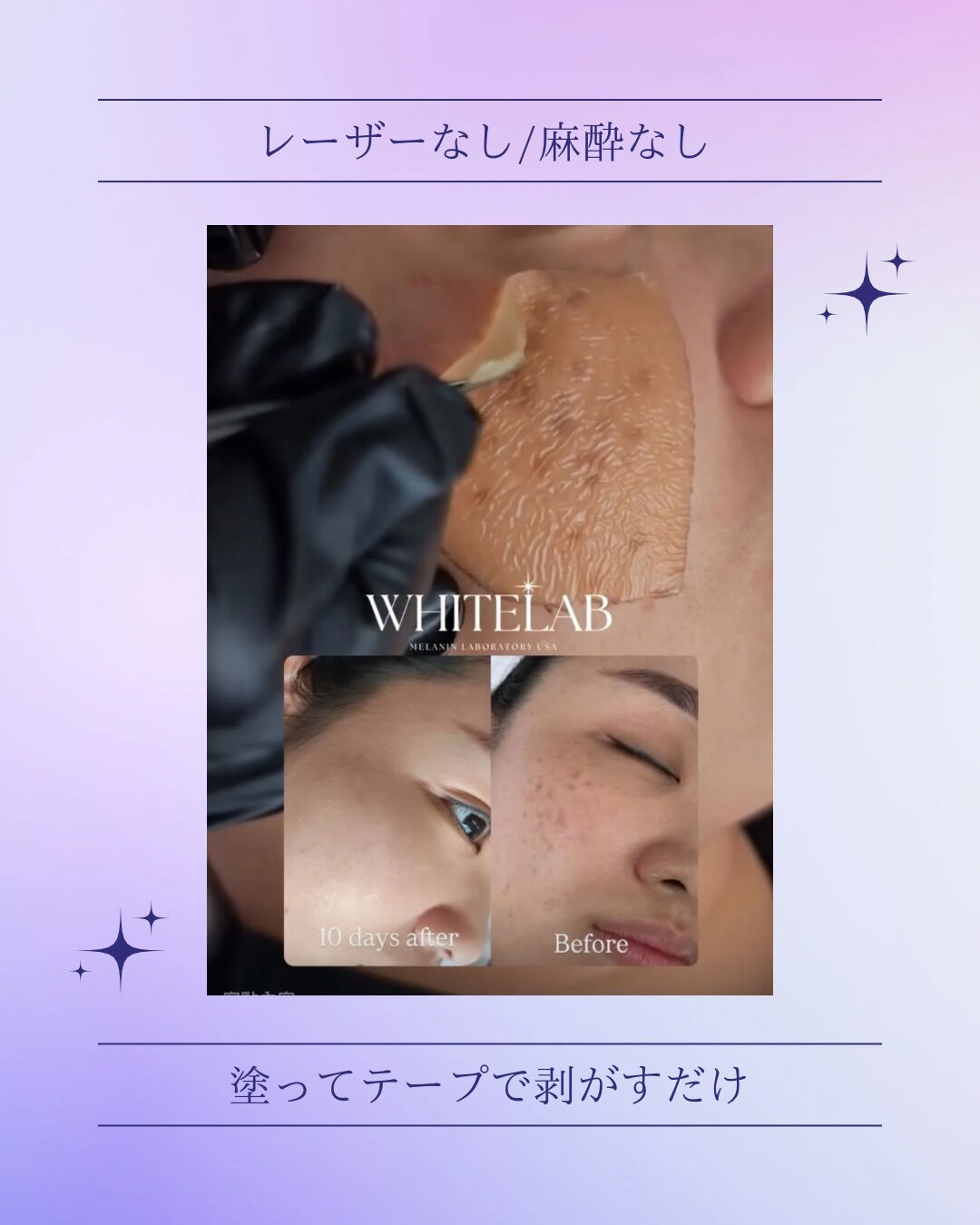 ⚫︎高崎の美容サロン 