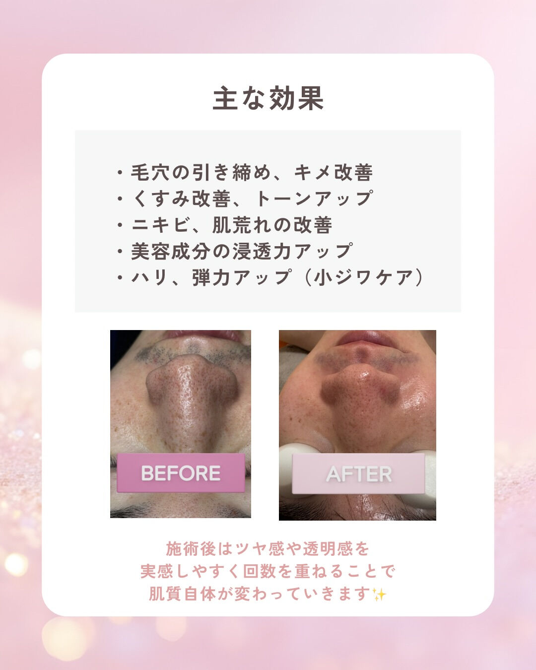 👇他の投稿はこちら