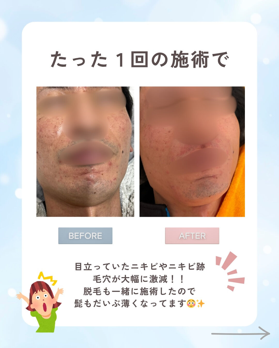 👇他の投稿はこちら