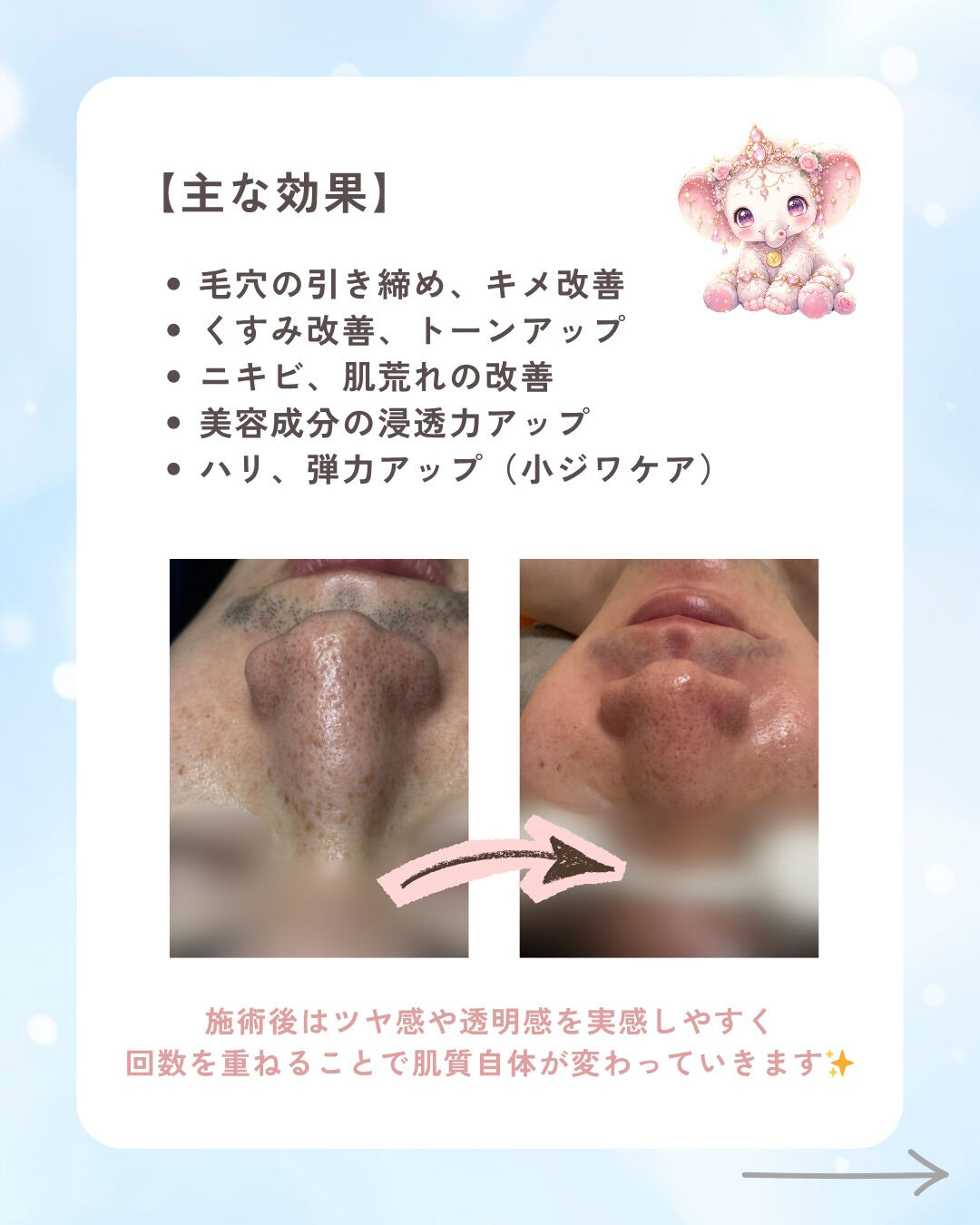 👇他の投稿はこちら